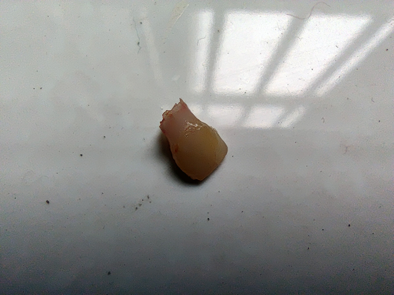 掉第二颗牙.jpg 掉第二颗牙.jpg